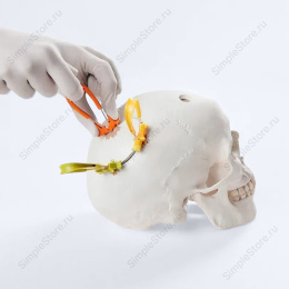 Краниофиксатор Neos Surgeru CRANIAL loop (XL) для краниопластики и трепанации черепа